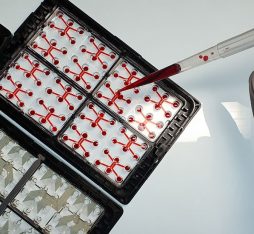 A gloved hand uses a pipette to add red liquid into culture plates in a laboratory setting.